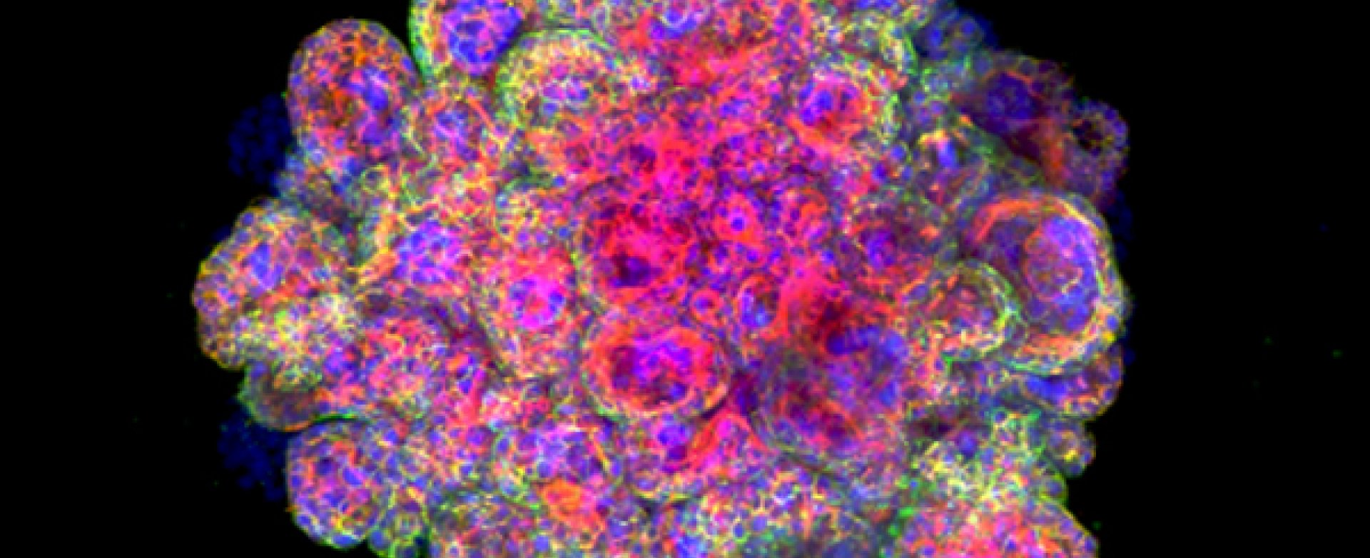 trophoblast